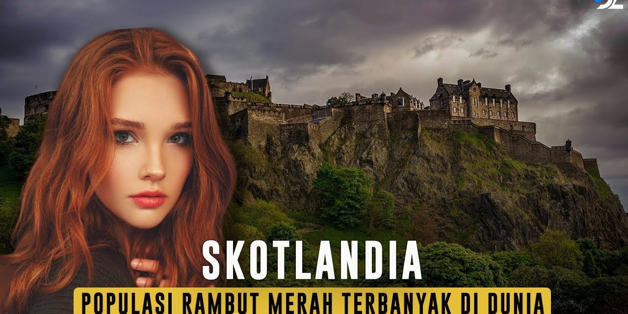 Keunikan Populasi Di Skotlandia Dan Rambut Merah Yang Khas