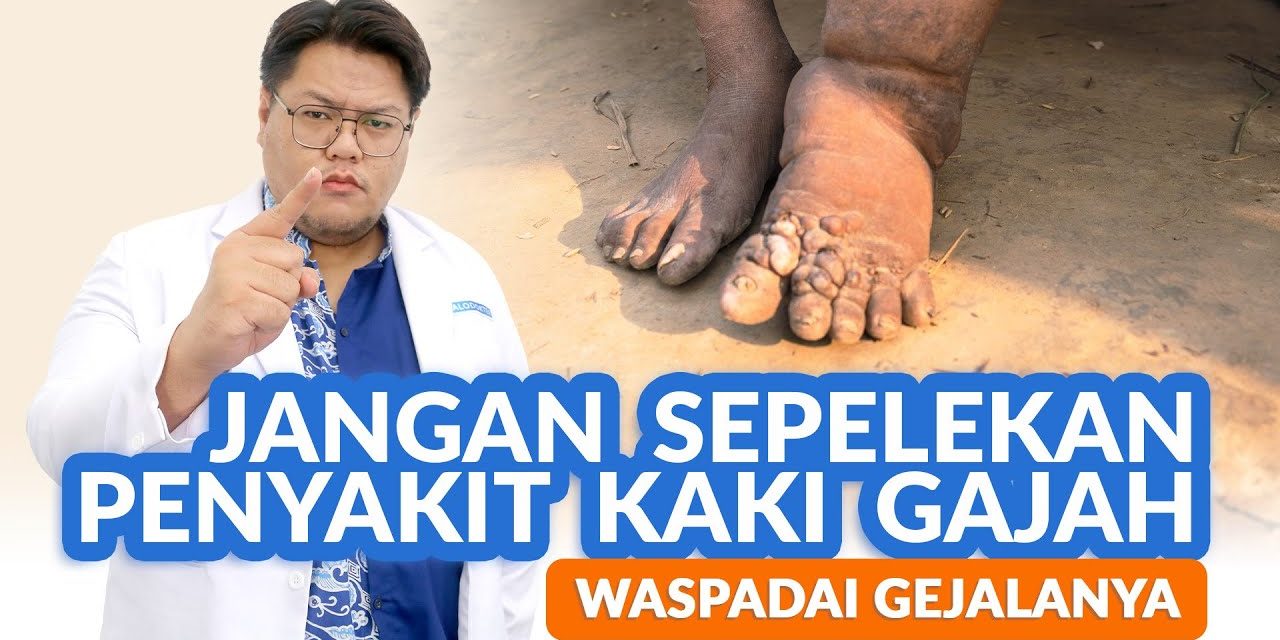 Penyakit Kaki Gajah Karena Adanya Infeksi Cacing Parasite Filaria
