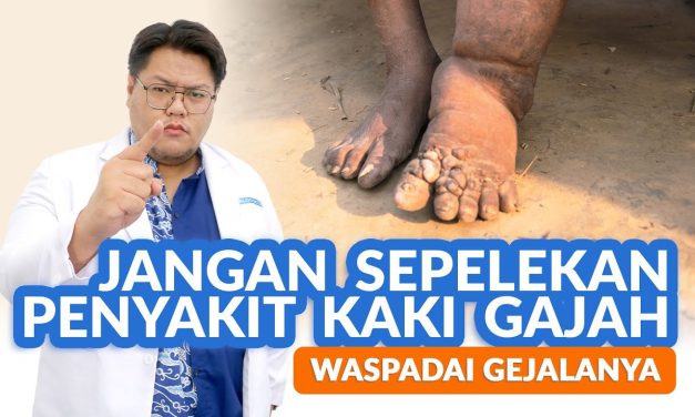 Penyakit Kaki Gajah Karena Adanya Infeksi Cacing Parasite Filaria