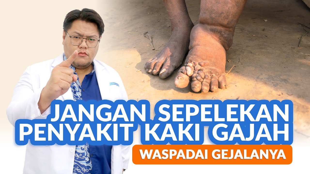 Penyakit Kaki Gajah